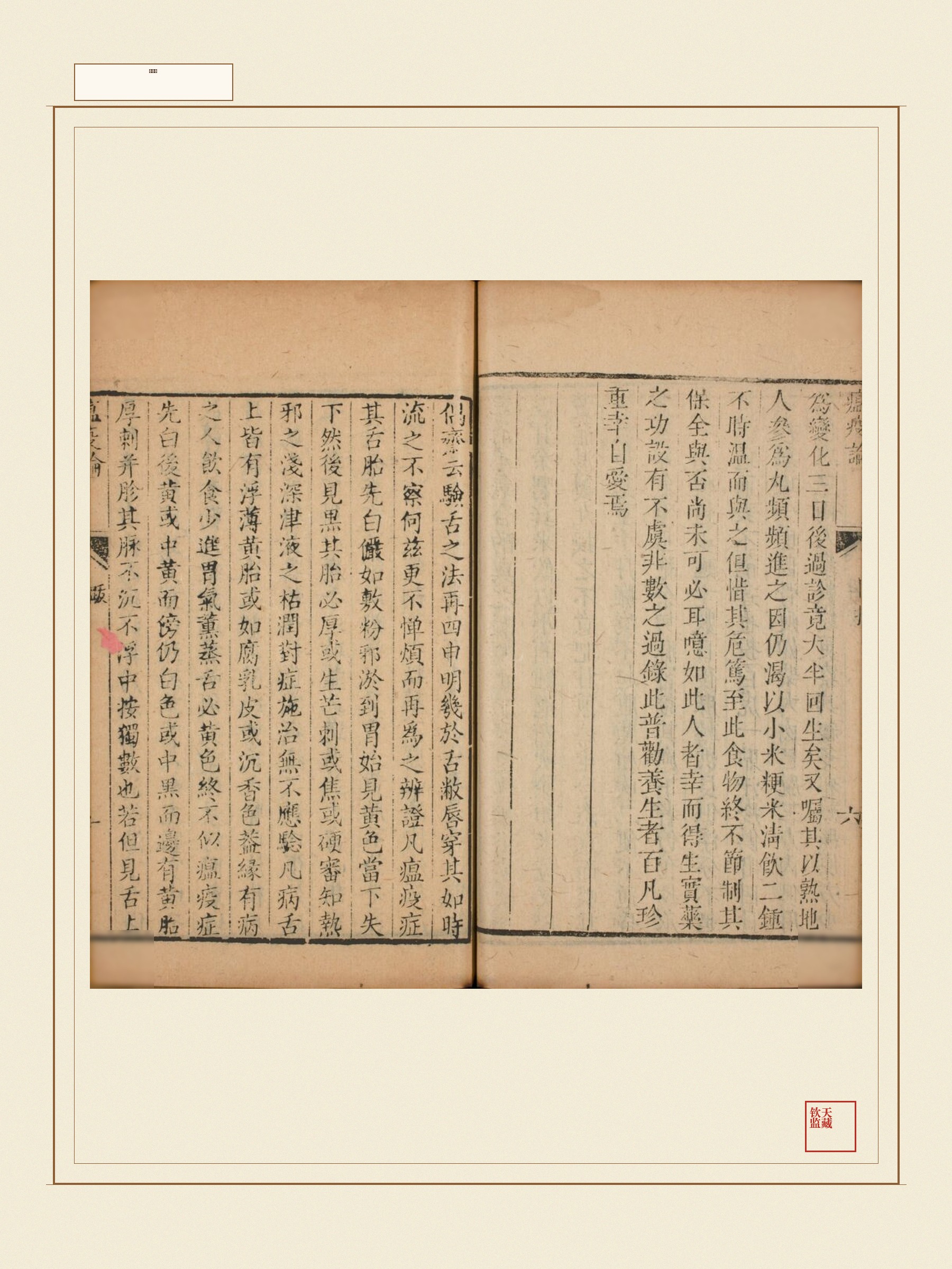 瘟疫论 第3页