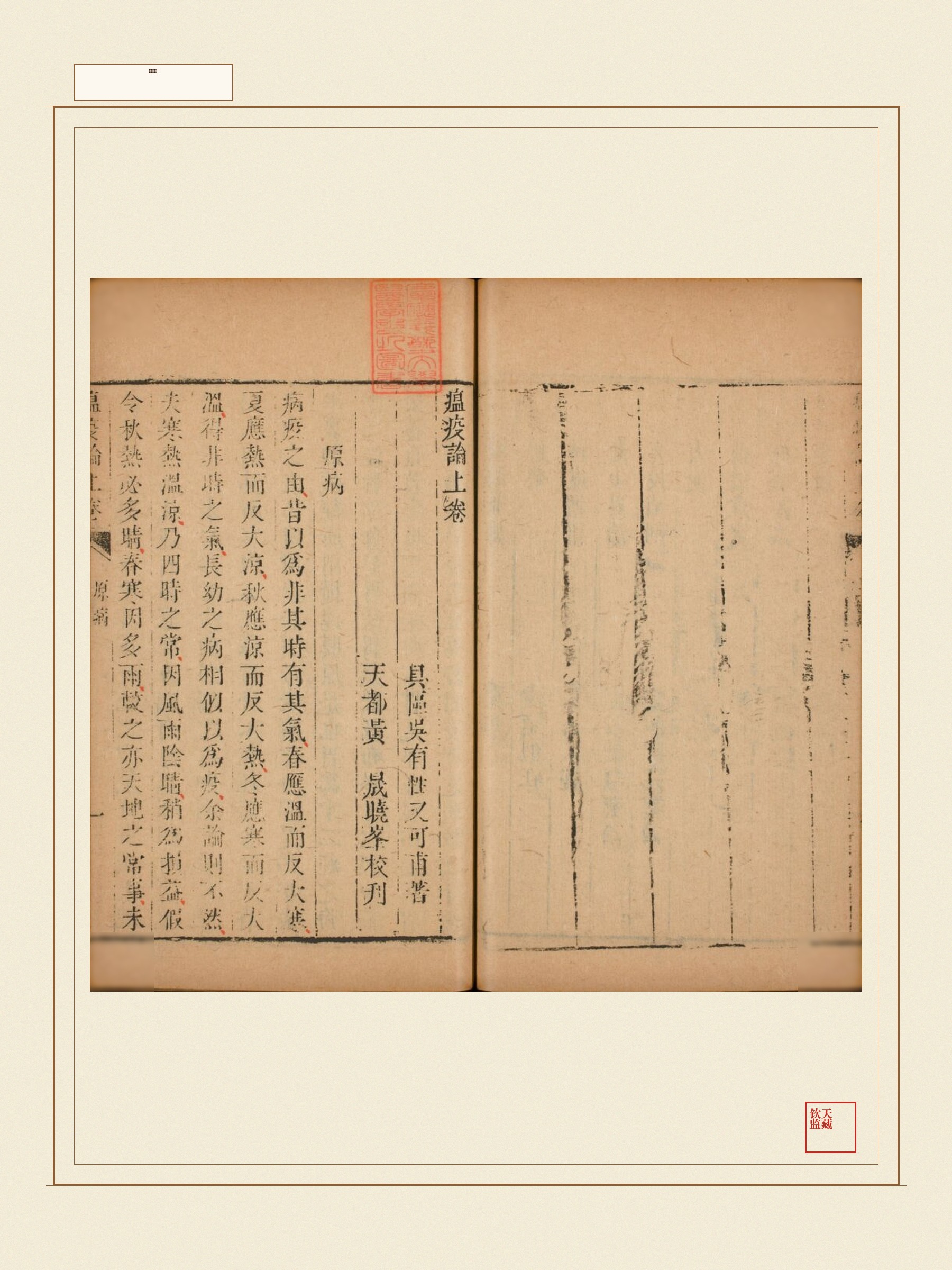 瘟疫论 第4页
